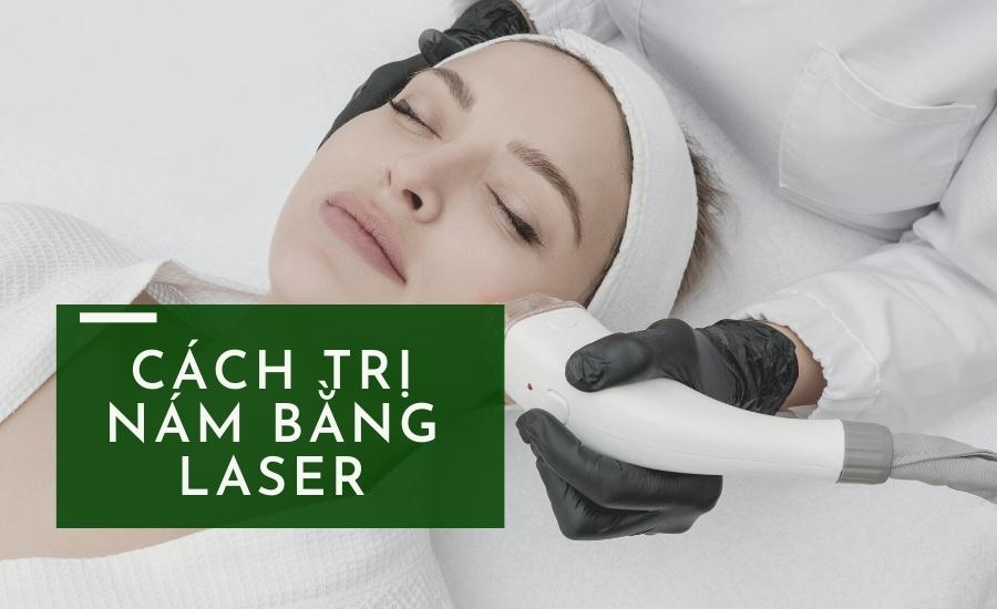 Điều trị nám da bằng laser có những ưu và nhược điểm gì?